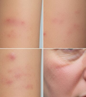 Understanding skin reactions caused by psychiatric medications and treatment options.