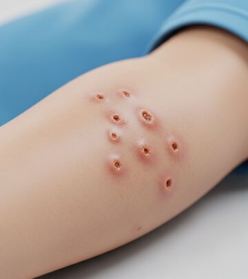 Comprehensive insights into preventing, recognizing, and treating school sores in children and adults.